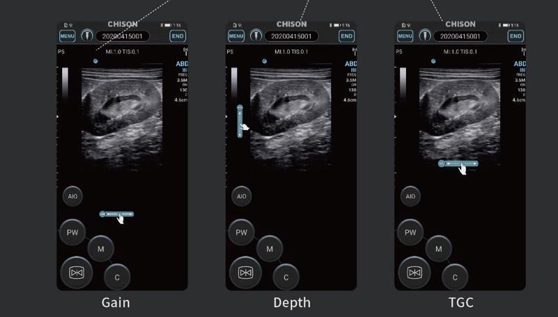 Chison SonoEye P3 VET Phased Array | Handheld Veterinary Ultrasounds